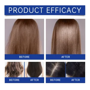 EELHOE 30ml Copper Peptide Hair Growth Oil